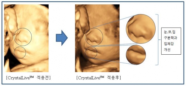 크리스탈라이브 영상처리엔진 적용 전후 비교. 사진=삼성전자