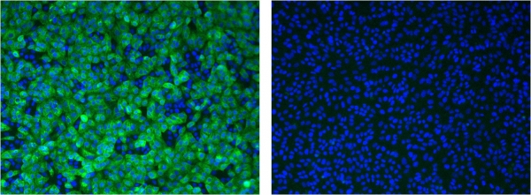 ▲ 왼쪽 형광색이 감염된 세포, 오른쪽 파란색이 정상세포 사진다만, 위 사진은 '니클로사미드' 또는 '나파모스타트' 투여시의 사진은 아니지만,이와 비슷하게 목표한다고 밝혔다.  (사진제공=한국파스퇴르연구소)