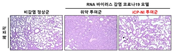 ▲사진설명: RNA 바이러스 감염 코로나19모델의 폐 조직 (가운데)이 완전히 파괴되어 산소교환을 위한 폐 다공성 구조 (왼쪽)가 무너졌으나, iCP-NI 투여군 (오른쪽)은 정상화 되었음(사진제공_셀리버리)